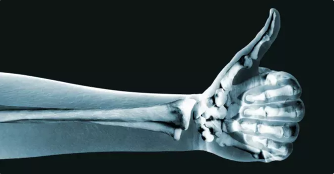Kemikleri Güçlendirmek: Kolay ve Etkili Kemik Güçlendirici Tavsiyeler